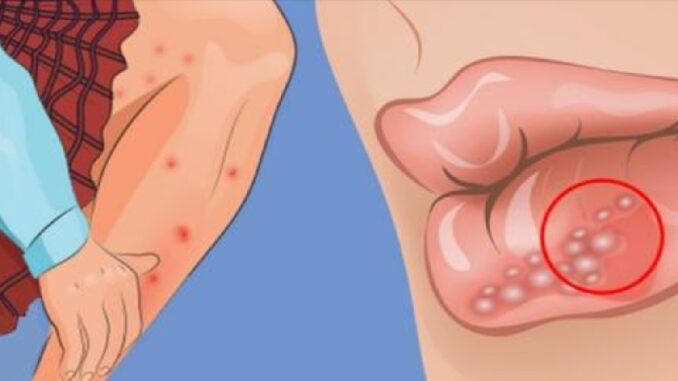 chronické onemocnění